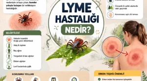 Lyme Hastalığı Nedir ve Deri Hastalığı Hakkında Bilmeniz Gerekenler