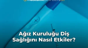 Ağız Kuruluğu Diş Sağlığını Nasıl Etkiler?