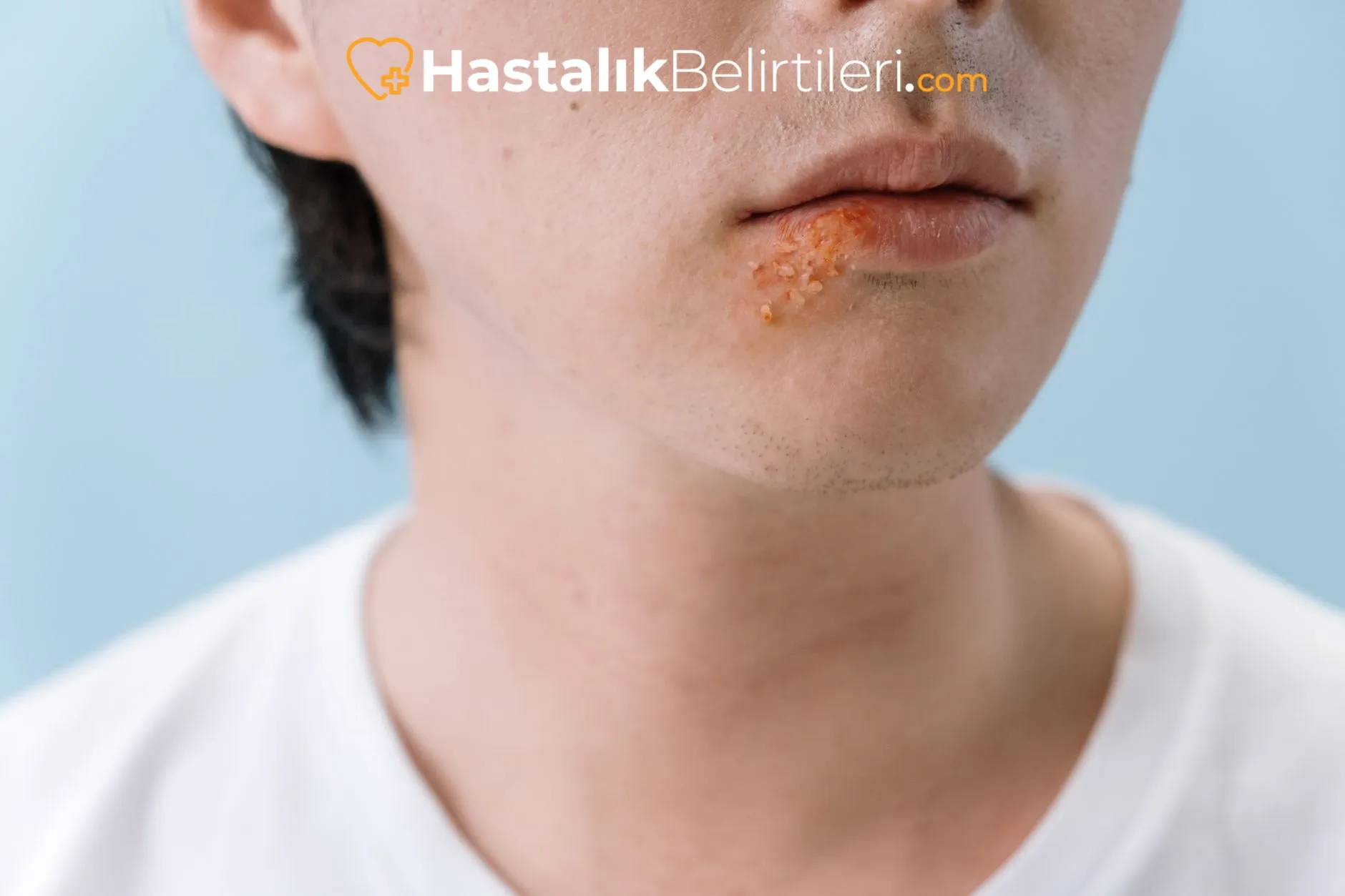 ağız kuruluğu neden olur? hangi hastalıkların habercisi olabilir?