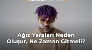 Ağız Yaraları Neden Oluşur, Ne Zaman Gitmeli?