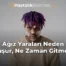 Ağız Yaraları Neden Oluşur, Ne Zaman Gitmeli?