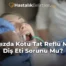 Ağızda Kötü Tat Reflü Mü, Diş Eti Sorunu Mu?