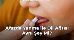 Ağızda Yanma ile Dil Ağrısı Aynı Şey Mi?