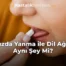 Ağızda Yanma ile Dil Ağrısı Aynı Şey Mi?