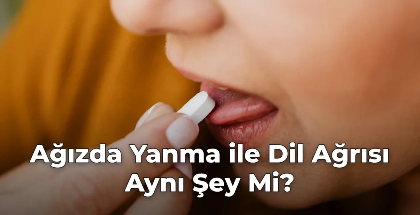Ağızda Yanma ile Dil Ağrısı Aynı Şey Mi?
