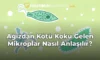 Ağızdan Kötü Koku Gelen Mikroplar Nasıl Anlaşılır?