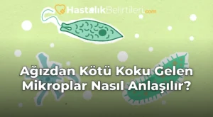 Ağızdan Kötü Koku Gelen Mikroplar Nasıl Anlaşılır?