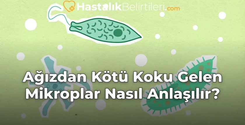 Ağızdan Kötü Koku Gelen Mikroplar Nasıl Anlaşılır?