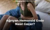 Ağrıyan Hemoroid Evde Nasıl Geçer?