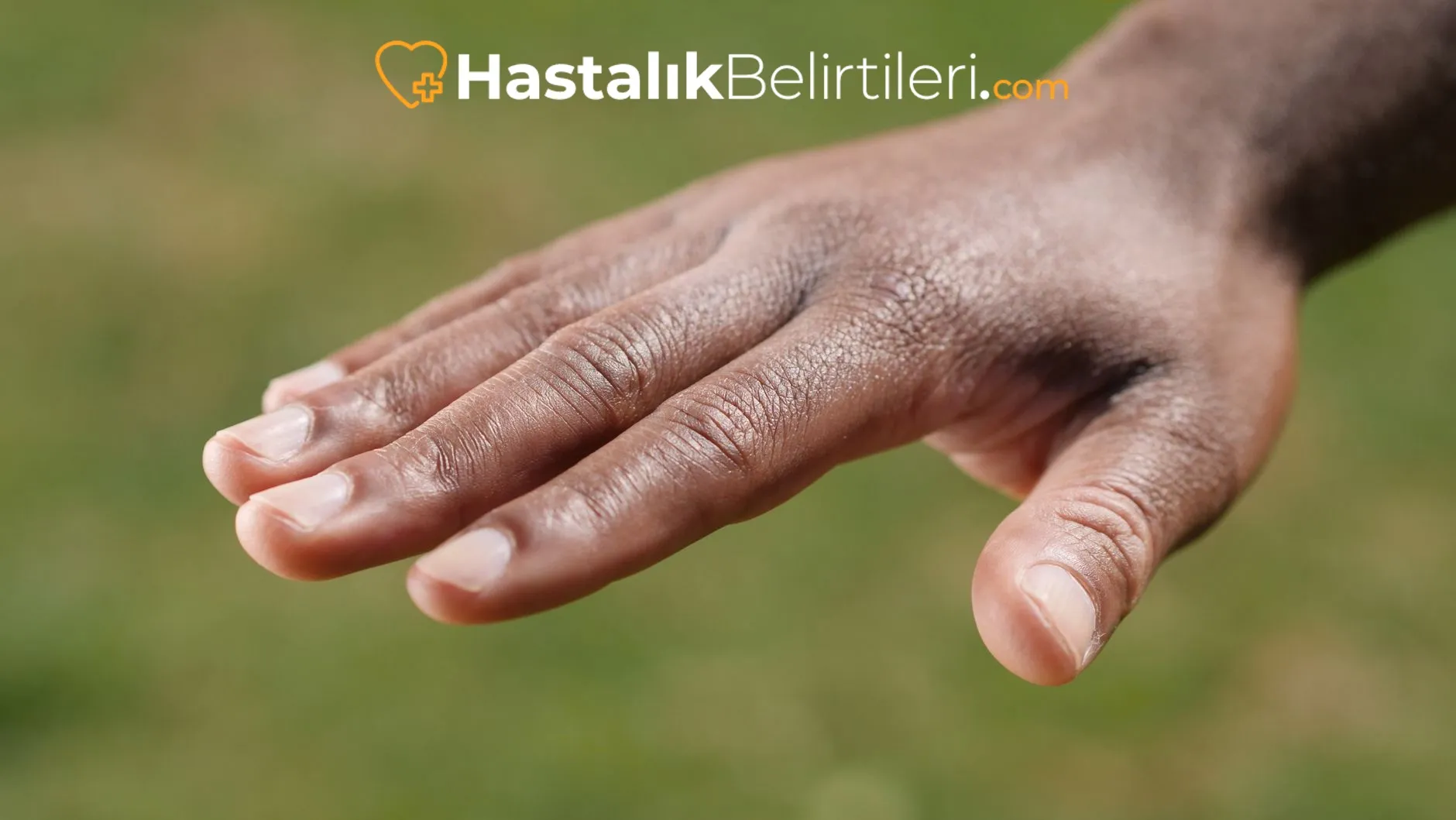 Alevlenme sırasında el avuç içinde sıcaklık artışı