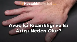 Avuç İçi Kızarıklığı ve Isı Artışı Neden Olur?