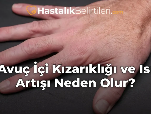 Avuç İçi Kızarıklığı ve Isı Artışı Neden Olur?