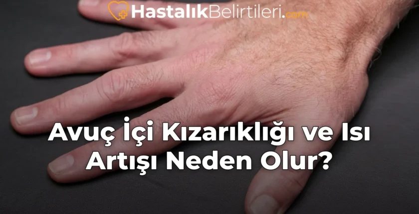 Avuç İçi Kızarıklığı ve Isı Artışı Neden Olur?