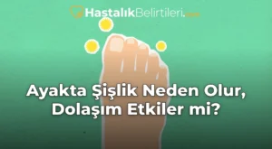 Ayakta Şişlik Neden Olur, Dolaşım Etkiler mi?