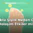 Ayakta Şişlik Neden Olur, Dolaşım Etkiler mi?
