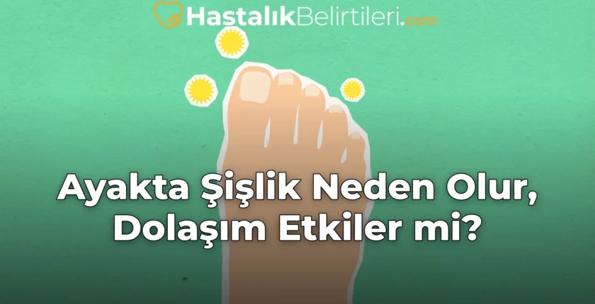 Ayakta Şişlik Neden Olur, Dolaşım Etkiler mi?
