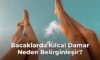 Bacaklarda Kılcal Damar Neden Belirginleşir?