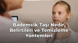Bademcik Taşı Nedir, Belirtileri ve Temizleme Yöntemleri