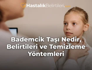 Bademcik Taşı Nedir, Belirtileri ve Temizleme Yöntemleri
