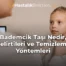 Bademcik Taşı Nedir, Belirtileri ve Temizleme Yöntemleri