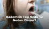 Bademcik Taşı Nedir ve Neden Oluşur? Bademcik Taşı Nedir ve Neden Oluşur?