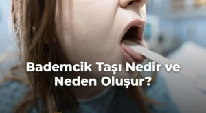 Bademcik Taşı Nedir ve Neden Oluşur?