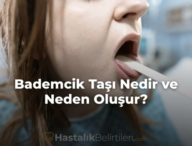 Bademcik Taşı Nedir ve Neden Oluşur?