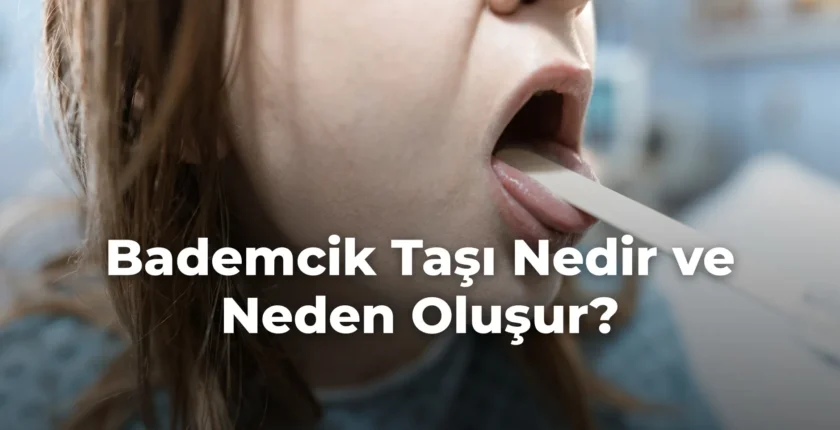 Bademcik Taşı Nedir ve Neden Oluşur?