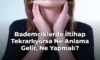 Bademciklerde İltihap Tekrarlıyorsa Ne Anlama Gelir, Ne Yapmalı? Bademciklerde İltihap Tekrarlıyorsa Ne Anlama Gelir, Ne Yapmalı?
