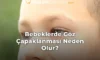 Bebeklerde Göz Çapaklanması Neden Olur?