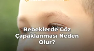 Bebeklerde Göz Çapaklanması Neden Olur?
