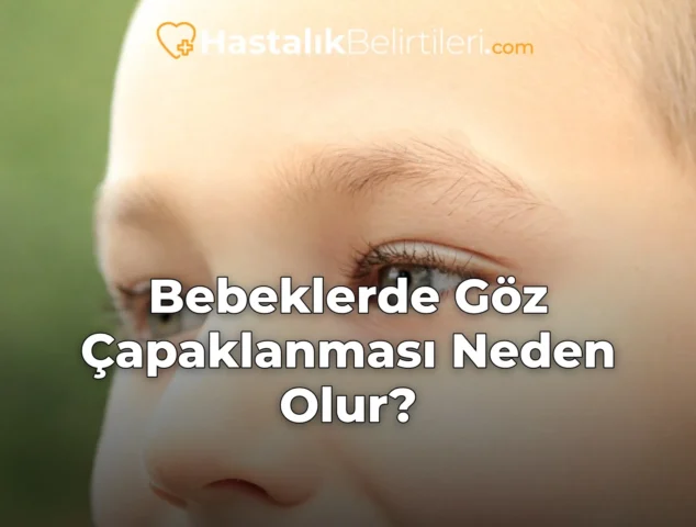 Bebeklerde Göz Çapaklanması Neden Olur?