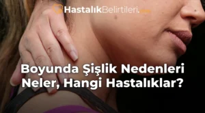 Boyunda Şişlik Nedenleri Neler, Hangi Hastalıklar? Boyunda Şişlik Nedenleri Neler, Hangi Hastalıklar?