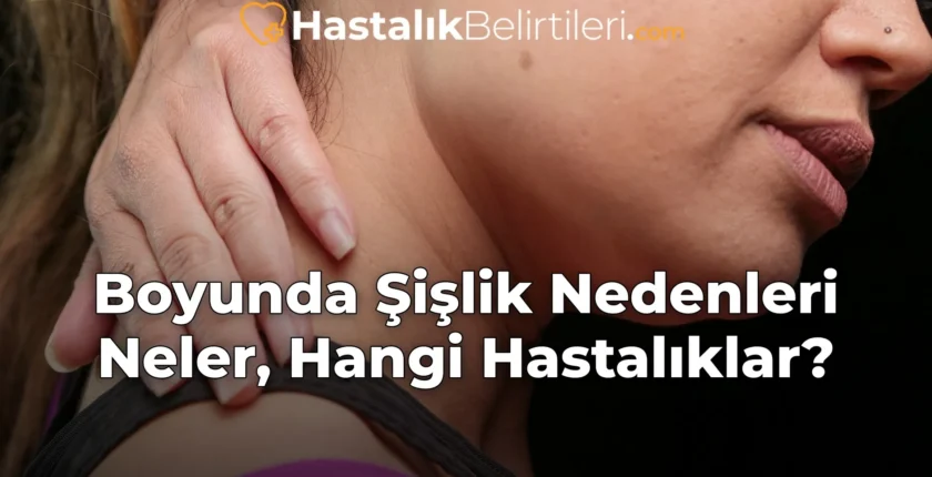 Boyunda Şişlik Nedenleri Neler, Hangi Hastalıklar? Boyunda Şişlik Nedenleri Neler, Hangi Hastalıklar?