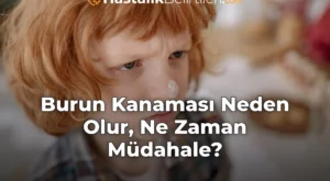Burun Kanaması Neden Olur, Ne Zaman Müdahale?