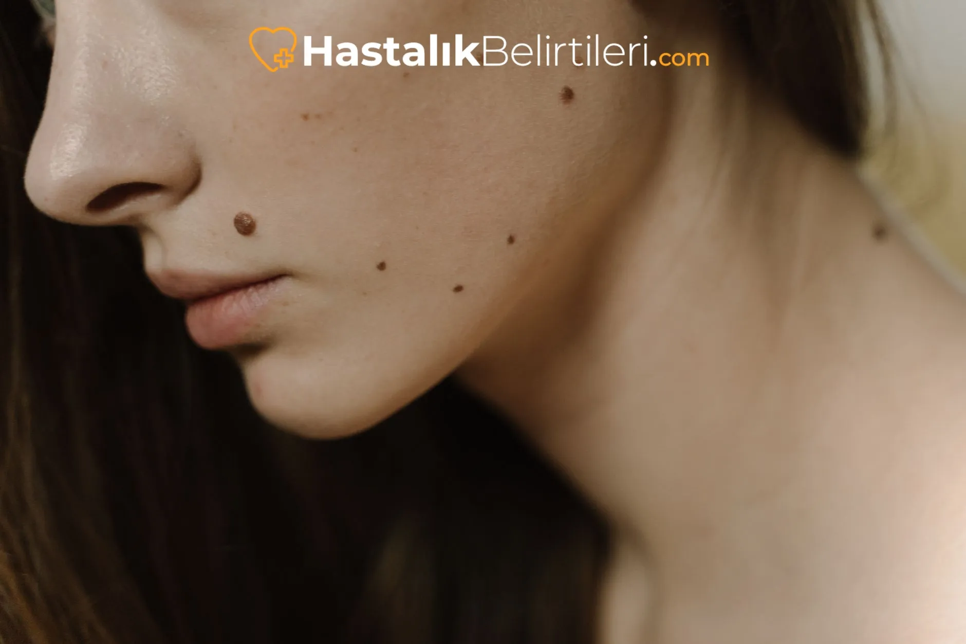Ciltte Gece Kaşıntısı Neden Artar? 4 Kuru cilt ve nem kaybı: gece boyunca artan kaşıntı