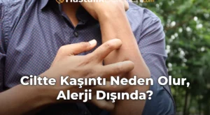 Ciltte Kaşıntı Neden Olur, Alerji Dışında?