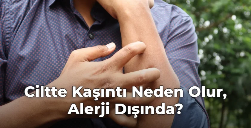 Ciltte Kaşıntı Neden Olur, Alerji Dışında?