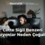 Ciltte Siğil Benzeri Lezyonlar Neden Çoğalır?