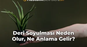 Deri Soyulması Neden Olur, Ne Anlama Gelir?