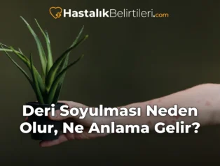 Deri Soyulması Neden Olur, Ne Anlama Gelir?