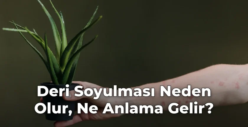 Deri Soyulması Neden Olur, Ne Anlama Gelir?