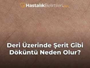 Deri Üzerinde Şerit Gibi Döküntü Neden Olur?