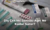 Diş Çekimi Sonrası Ağrı Ne Kadar Sürer? Diş Çekimi Sonrası Ağrı Ne Kadar Sürer?
