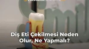 Diş Eti Çekilmesi Neden Olur, Ne Yapmalı?