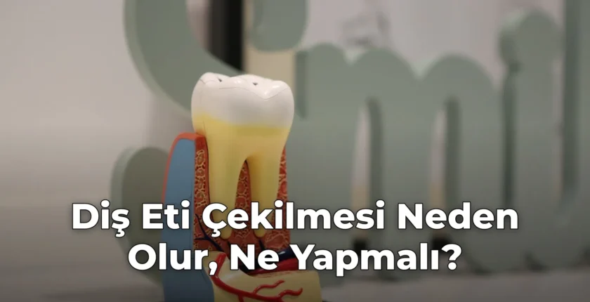Diş Eti Çekilmesi Neden Olur, Ne Yapmalı?