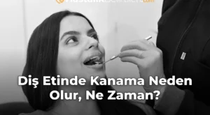 Diş Etinde Kanama Neden Olur, Ne Zaman?