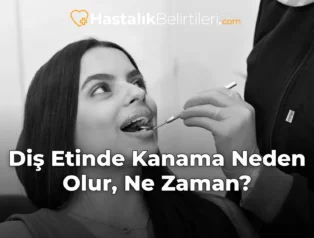 Diş Etinde Kanama Neden Olur, Ne Zaman?