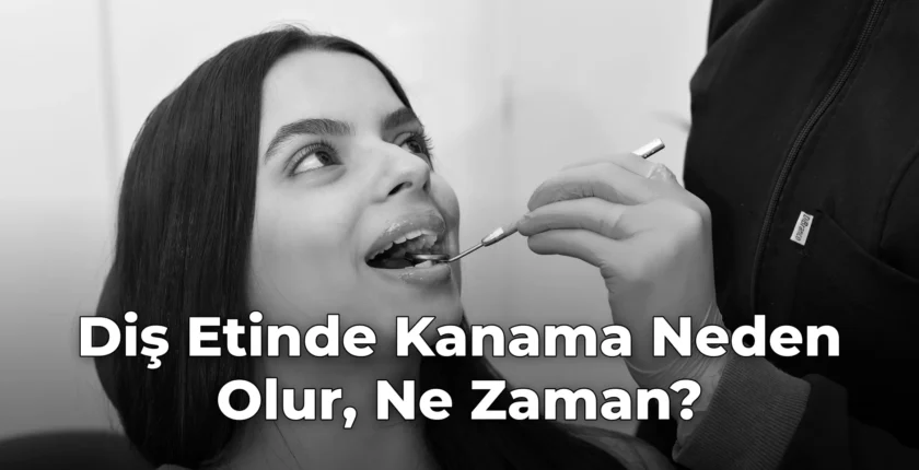 Diş Etinde Kanama Neden Olur, Ne Zaman?
