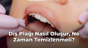 Diş Plağı Nasıl Oluşur, Ne Zaman Temizlenmeli?